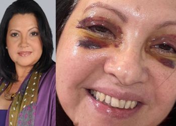 Reaparece la actriz venezolana Beatríz Valdez a sus 58 años con hematomas en su rostro