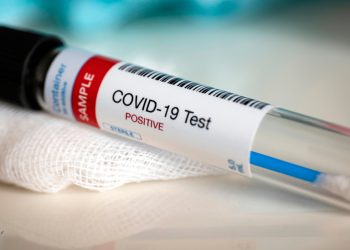 Venezuela registra 1.041 nuevos contagios de covid-19