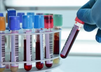 Desarrollan método para detectar enfermedades renales a través de una gota de sangre