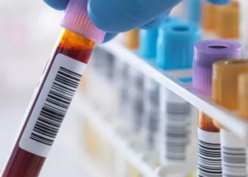 Hepatitis misteriosa cobra la vida de 6 niños en Estados Unidos