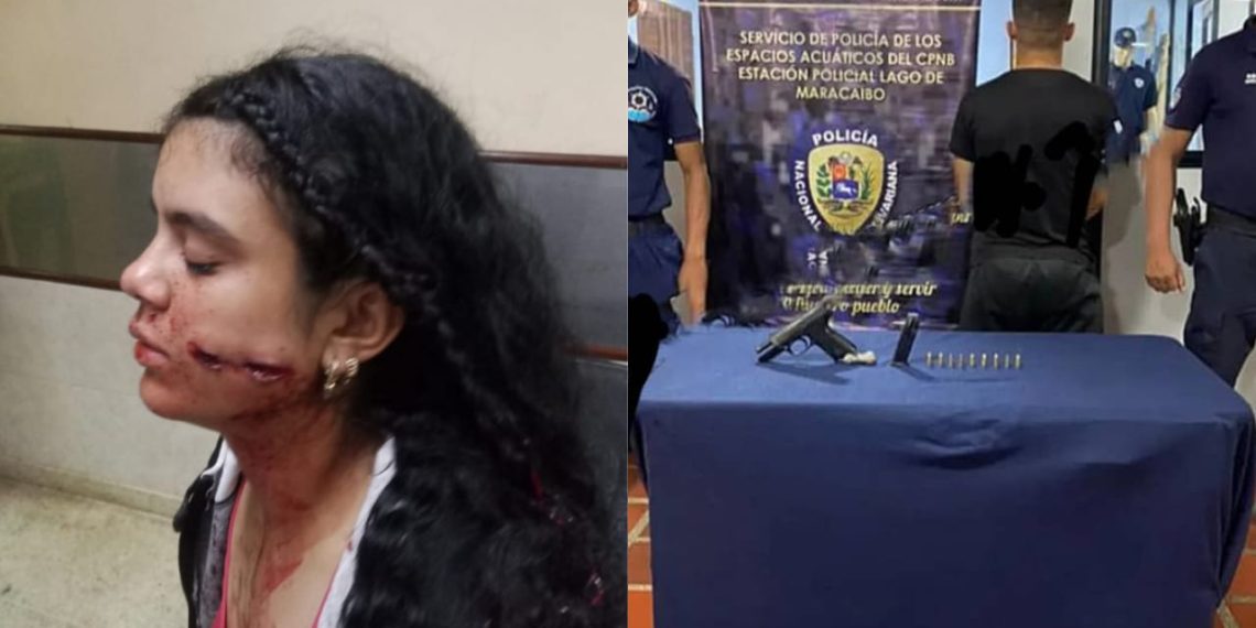 Un PNB disparó en el rostro a su compañera en comando de San Francisco