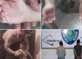 Detienen a pareja que les quemó las manos a sus hijos con unas cucharillas en Caracas